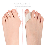 Pack of 2 Hallux Valgus Toe Separators – Bunion Corrector for Big Toe Alignment