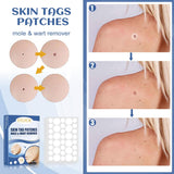 144Pcs Skin Tag Patches Mole Wart r Natural Ingredients Soften Keratin Painless Removal