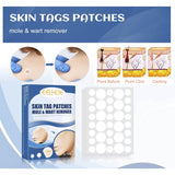 144Pcs Skin Tag Patches Mole Wart r Natural Ingredients Soften Keratin Painless Removal