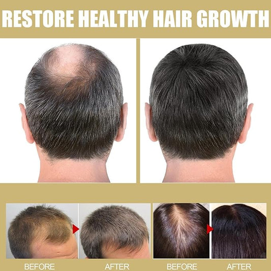 LED Hair Growth Cap – Infrared Red Light Scalp Therapy Device for Hair Care & Nourishment