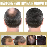 LED Hair Growth Cap – Infrared Red Light Scalp Therapy Device for Hair Care & Nourishment